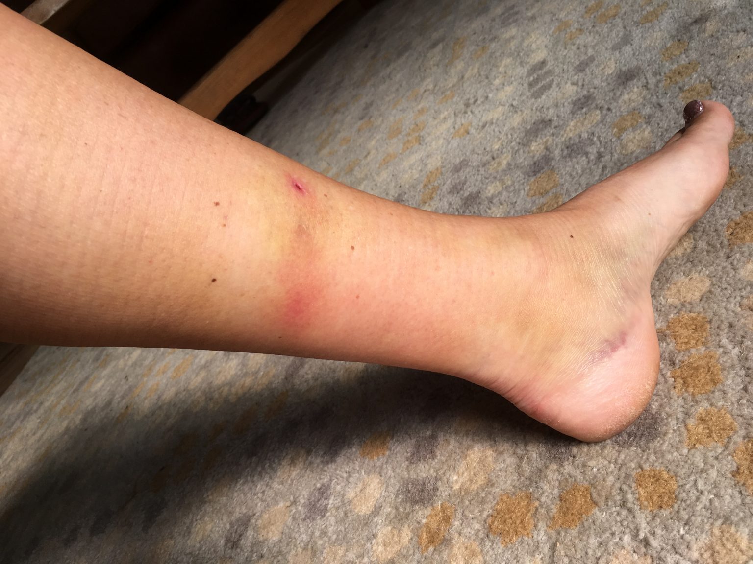 Scar Tissue Hurts! Momentum Canine Clinical Massage